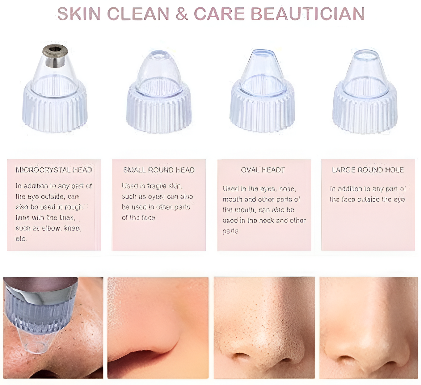 DermaSuction™ BlackHead Vacuum & Deep Pore Cleanser