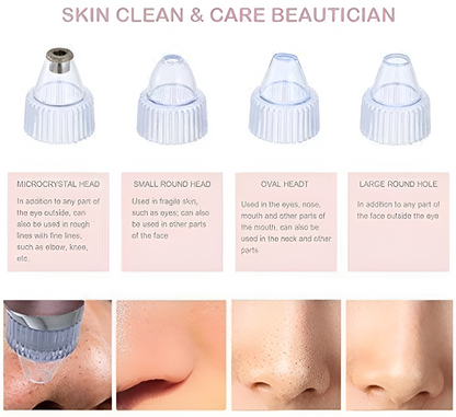 DermaSuction™ BlackHead Vacuum & Deep Pore Cleanser